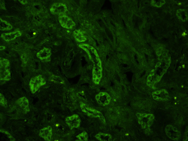 Mitofusin 2 Antibody in Immunohistochemistry (Paraffin) (IHC (P))