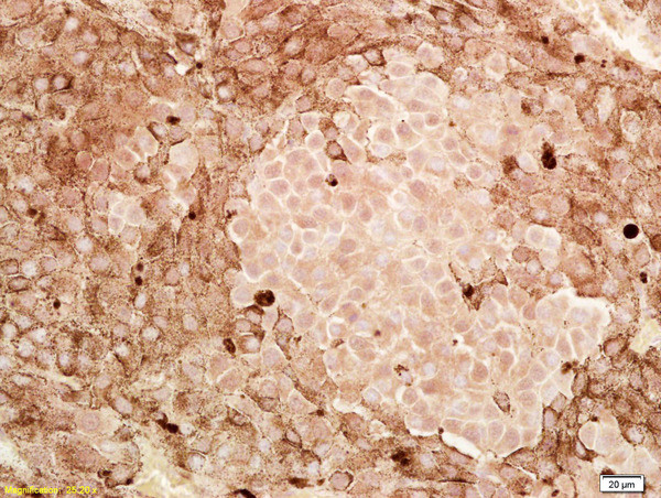 CITED1 Antibody in Immunohistochemistry (Paraffin) (IHC (P))