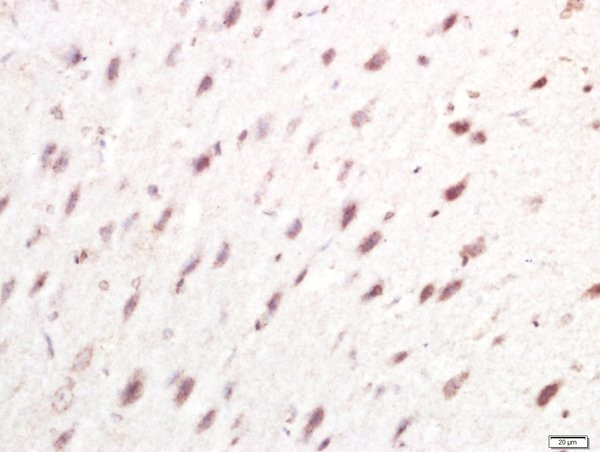 IRF7 Antibody in Immunohistochemistry (Paraffin) (IHC (P))