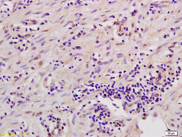 MSK1/2 Antibody in Immunohistochemistry (Paraffin) (IHC (P))