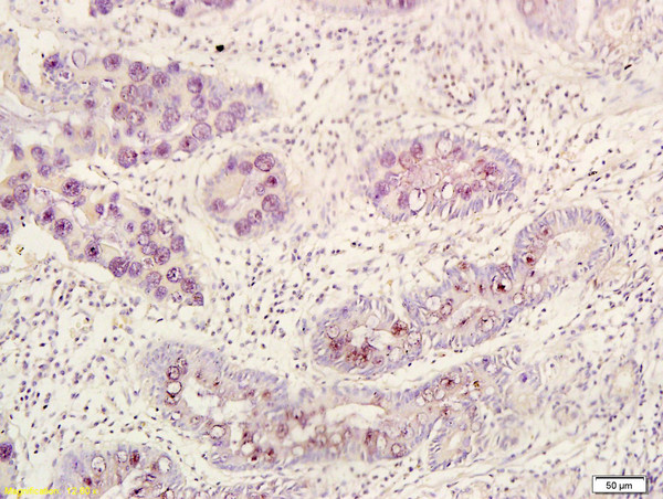 BMI1 Antibody in Immunohistochemistry (Paraffin) (IHC (P))