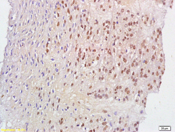 Phospho-Acinus (Ser1180) Antibody in Immunohistochemistry (Paraffin) (IHC (P))