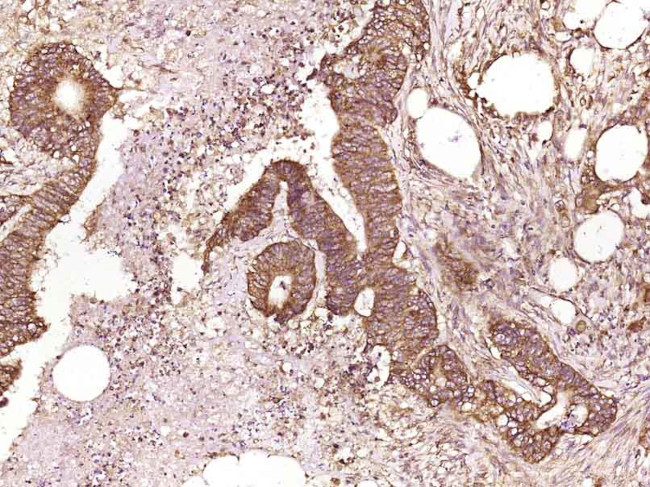 Phospho-arfaptin 2 (Ser260) Antibody in Immunohistochemistry (Paraffin) (IHC (P))