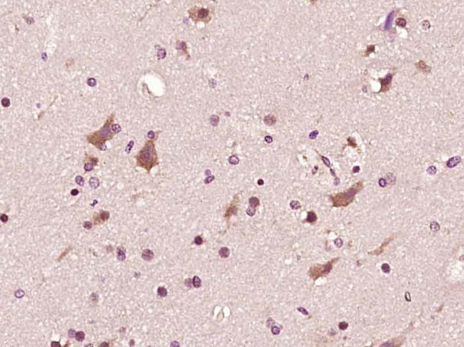 Phospho-ASK1 (Ser966) Antibody in Immunohistochemistry (Paraffin) (IHC (P))