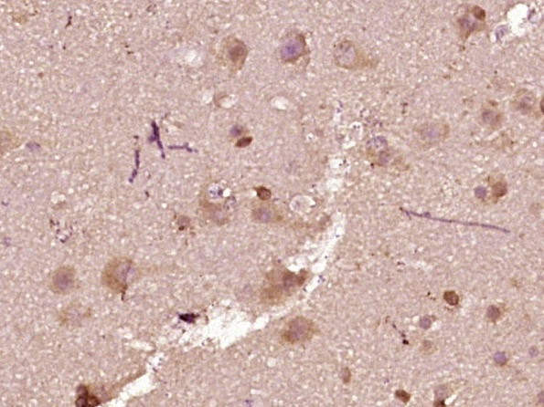 Phospho-BAD (Ser75) Antibody in Immunohistochemistry (Paraffin) (IHC (P))