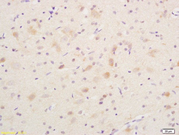 Phospho-B-Raf (Ser365) Antibody in Immunohistochemistry (Paraffin) (IHC (P))