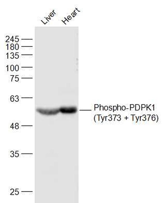 Phospho-PDPK1 (Tyr373, Tyr376) Antibody in Western Blot (WB)