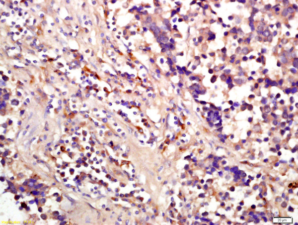 Phospho-eIF4EBP1 (Ser65) Antibody in Immunohistochemistry (Paraffin) (IHC (P))