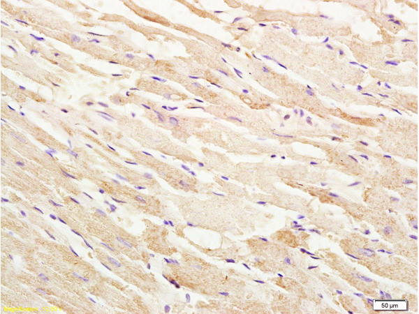 Phospho-ASK1 (Thr845) Antibody in Immunohistochemistry (Paraffin) (IHC (P))
