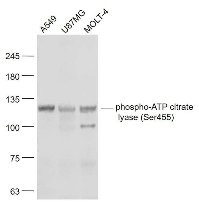 Phospho-ATP citrate lyase (Ser455) Antibody in Western Blot (WB)