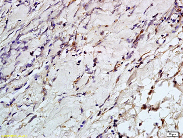 Phospho-Aurora A (Thr288) Antibody in Immunohistochemistry (Paraffin) (IHC (P))