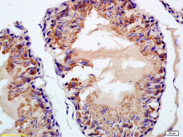 Phospho-BAP1 (Ser592) Antibody in Immunohistochemistry (Paraffin) (IHC (P))