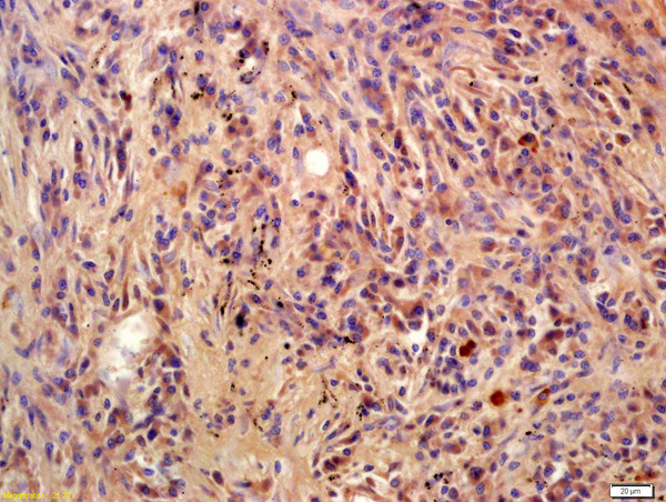 Phospho-BLNK (Tyr96) Antibody in Immunohistochemistry (Paraffin) (IHC (P))