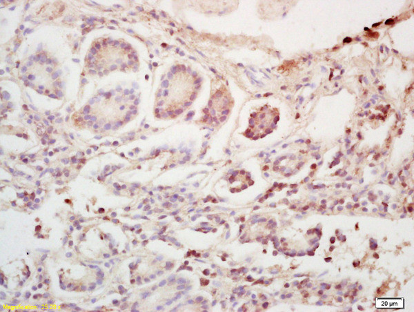 Phospho-Bim (Ser55) Antibody in Immunohistochemistry (Paraffin) (IHC (P))