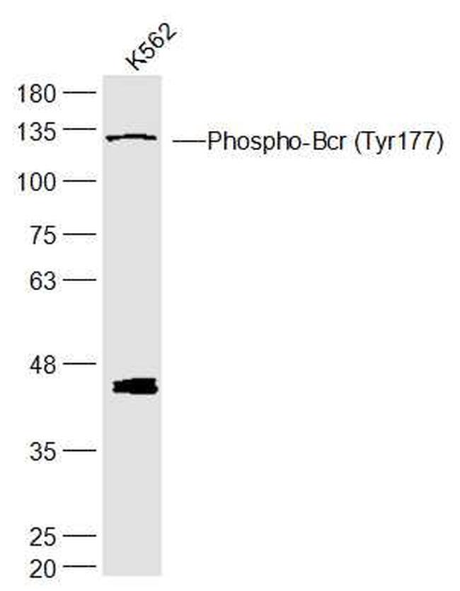 Phospho-Bcr (Tyr177) Antibody in Western Blot (WB)