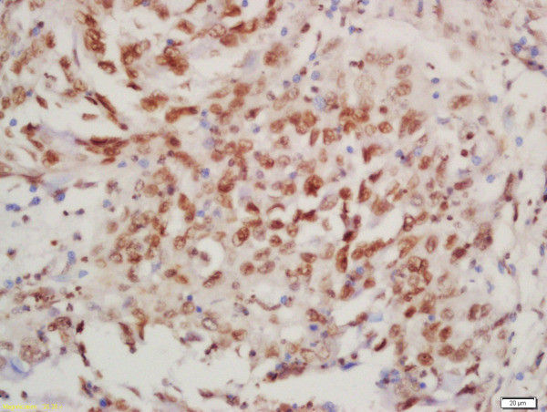 Phospho-BTK (Tyr223) Antibody in Immunohistochemistry (Paraffin) (IHC (P))