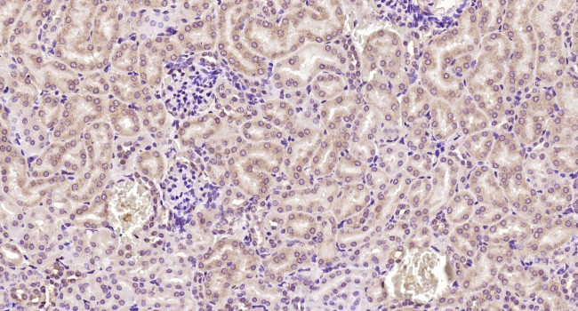 Phospho-CYLD (Ser418) Antibody in Immunohistochemistry (Paraffin) (IHC (P))