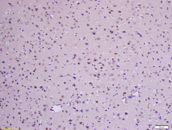 Phospho-beta Catenin (Ser33, Ser37) Antibody in Immunohistochemistry (Paraffin) (IHC (P))
