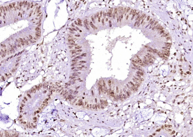 Phospho-Beta Catenin (Ser45) Antibody in Immunohistochemistry (Paraffin) (IHC (P))
