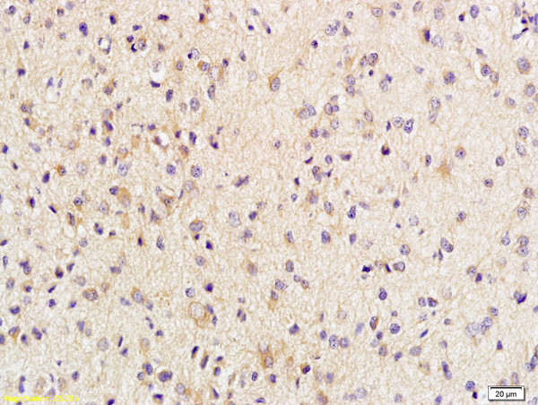 Phospho-Beta Catenin (Thr41, Ser45) Antibody in Immunohistochemistry (Paraffin) (IHC (P))