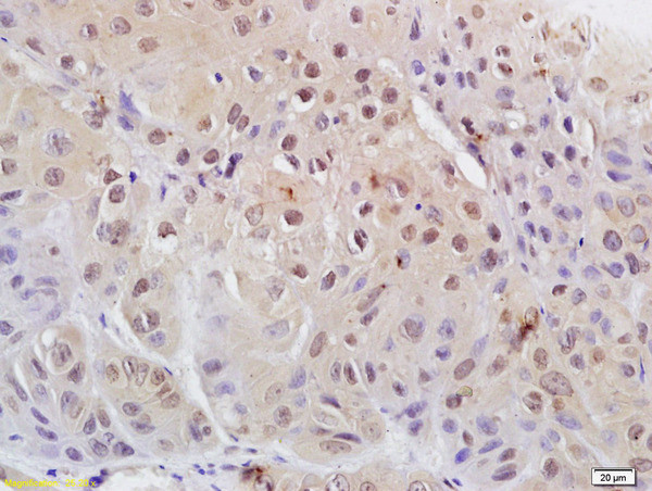 Phospho-CDK1 (Tyr15) Antibody in Immunohistochemistry (Paraffin) (IHC (P))