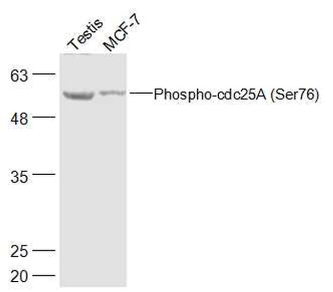 Phospho-cdc25A (Ser76) Antibody in Western Blot (WB)