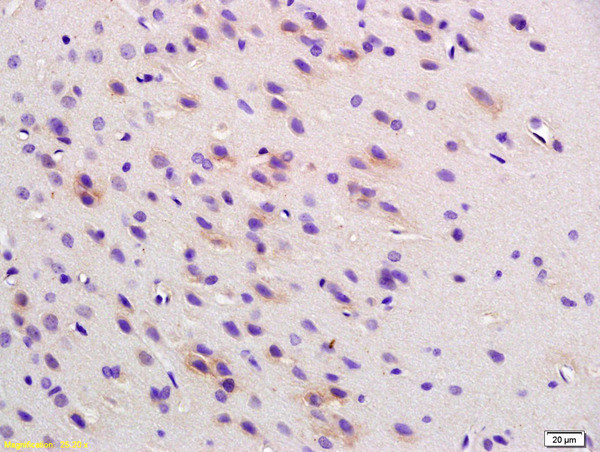 Phospho-Cofilin (Ser3) Antibody in Immunohistochemistry (Paraffin) (IHC (P))