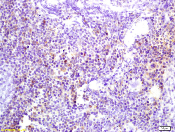 Phospho-DOK2 (Tyr139) Antibody in Immunohistochemistry (Paraffin) (IHC (P))