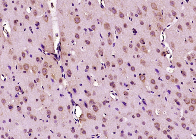 Phospho-Doublecortin (Ser47) Antibody in Immunohistochemistry (Paraffin) (IHC (P))