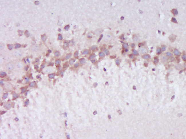 Phospho-Dab1 (Ser524) Antibody in Immunohistochemistry (Paraffin) (IHC (P))