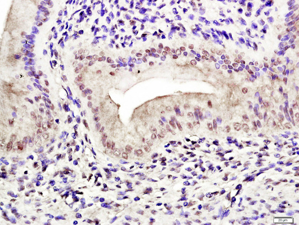 Phospho-Estrogen Receptor alpha (Ser118) Antibody in Immunohistochemistry (Paraffin) (IHC (P))
