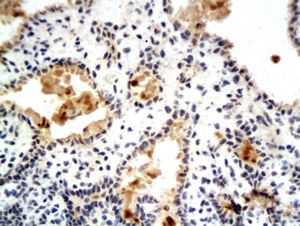 Phospho-Estrogen Receptor alpha (Ser104, Ser106) Antibody in Immunohistochemistry (Paraffin) (IHC (P))