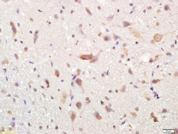 Phospho-FGFR1 (Tyr766) Antibody in Immunohistochemistry (Paraffin) (IHC (P))