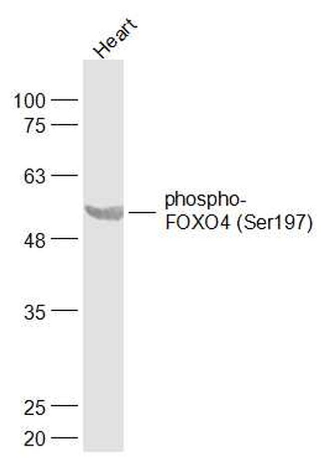 Phospho-FOXO4/FOXO1 (Ser197, Ser256) Antibody in Western Blot (WB)