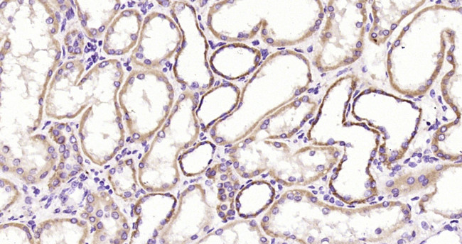 Phospho-GRB10 (Tyr67) Antibody in Immunohistochemistry (Paraffin) (IHC (P))