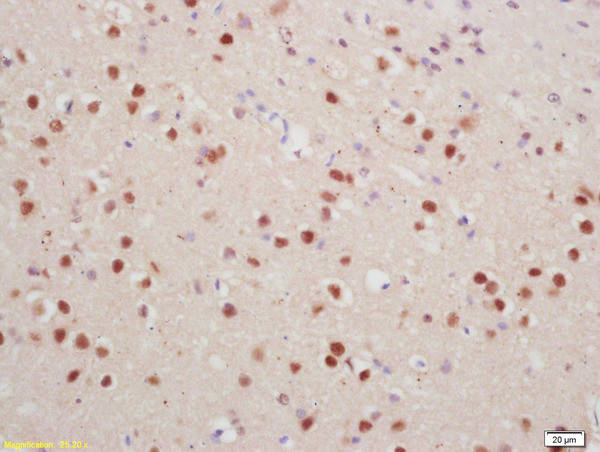 Phospho-Histone H1.4 (Thr18) Antibody in Immunohistochemistry (Paraffin) (IHC (P))