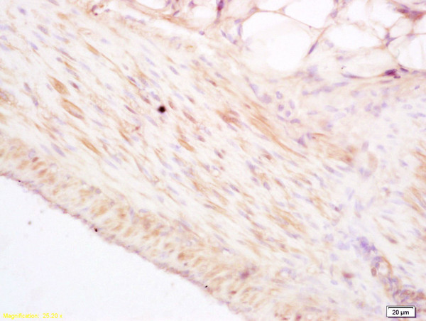 Phospho-HSP27 (Ser78) Antibody in Immunohistochemistry (Paraffin) (IHC (P))