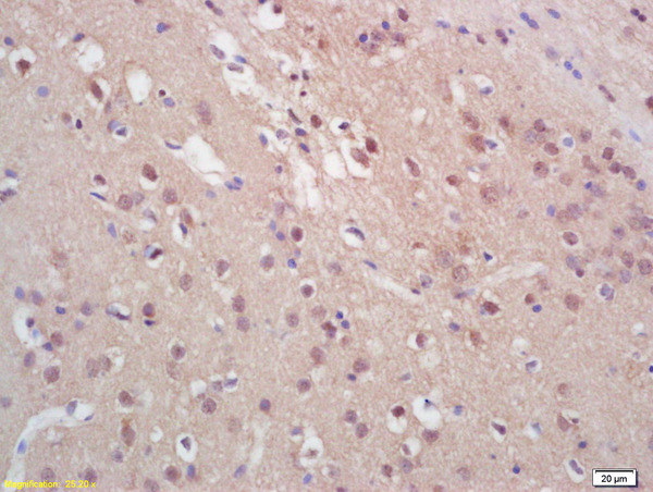Phospho-Histone H3 (Ser28) Antibody in Immunohistochemistry (Paraffin) (IHC (P))