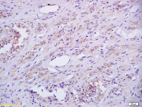 Phospho-IRAK1 (Thr387) Antibody in Immunohistochemistry (Paraffin) (IHC (P))