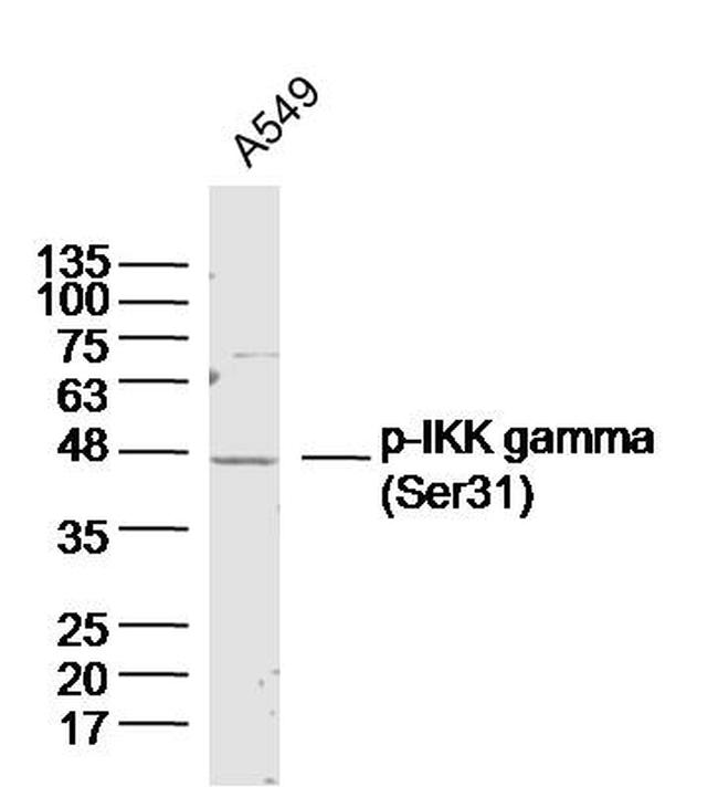 Phospho-IKK gamma (Ser31) Antibody in Western Blot (WB)