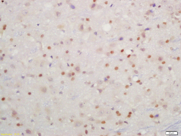 Phospho-IKK beta (Tyr199) Antibody in Immunohistochemistry (Paraffin) (IHC (P))