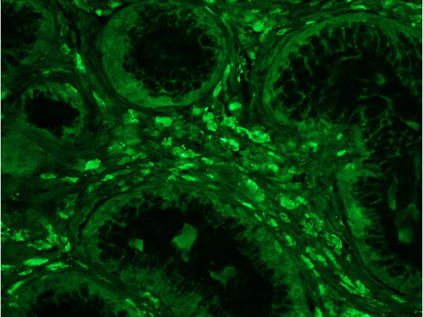 Phospho-IKK alpha/beta (Ser176, Ser180) Antibody in Immunohistochemistry (Paraffin) (IHC (P))
