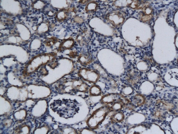 Phospho-c-Kit (Tyr721) Antibody in Immunohistochemistry (Paraffin) (IHC (P))