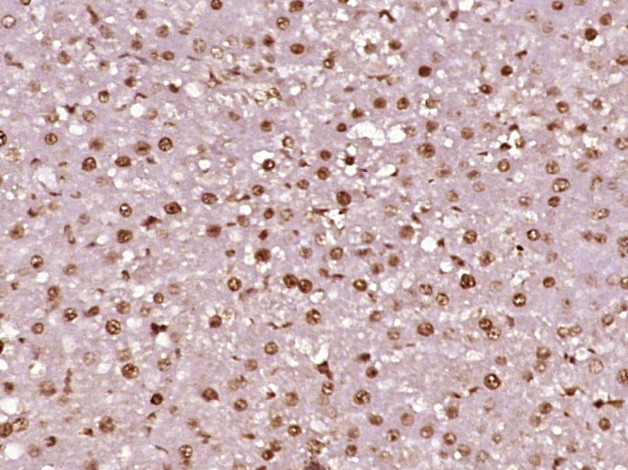 Phospho-LKB1 (Ser428) Antibody in Immunohistochemistry (Paraffin) (IHC (P))