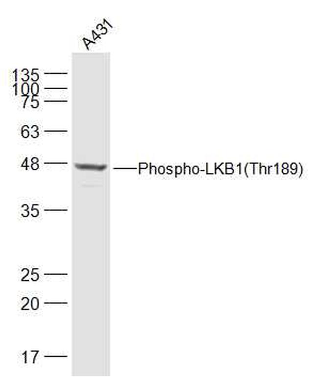 Phospho-LKB1 (Thr189) Antibody in Western Blot (WB)