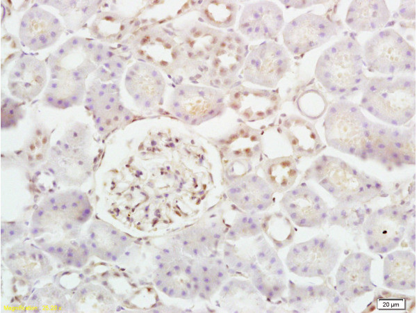 Phospho-5-Lipoxygenase (Ser663) Antibody in Immunohistochemistry (Paraffin) (IHC (P))