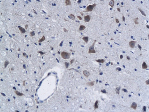 Phospho-Lyn (Tyr397) Antibody in Immunohistochemistry (Paraffin) (IHC (P))