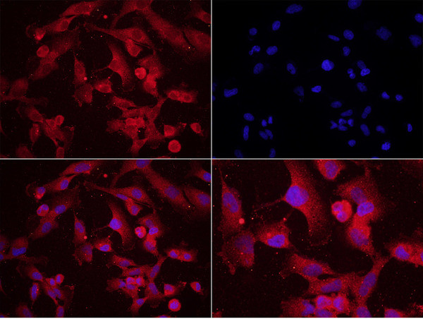 Phospho-MAP2 (Ser136) Antibody in Immunocytochemistry (ICC/IF)