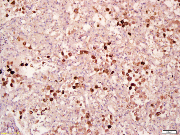 Phospho-MAPKAPK2 (Thr334) Antibody in Immunohistochemistry (Paraffin) (IHC (P))