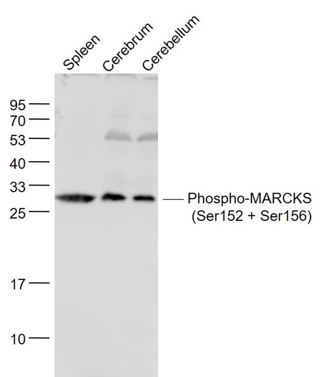 Phospho-MARCKS (Ser152, Ser156) Antibody in Western Blot (WB)